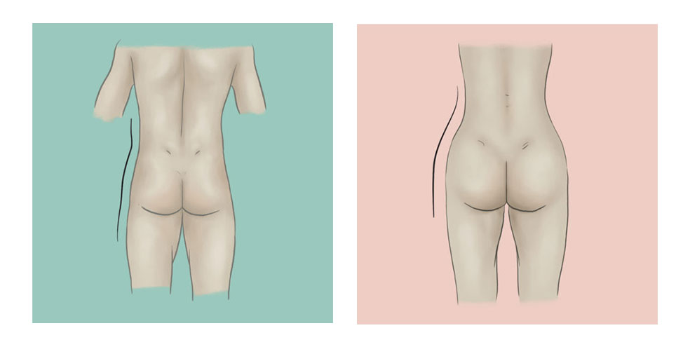 Male to Female Body Shaping: 5 Ways to Get Feminine Curves
