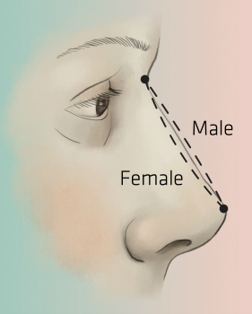 2passclinic before and after transwomen facial feminization FFS mtf nose feminization surgery rhinoplasty