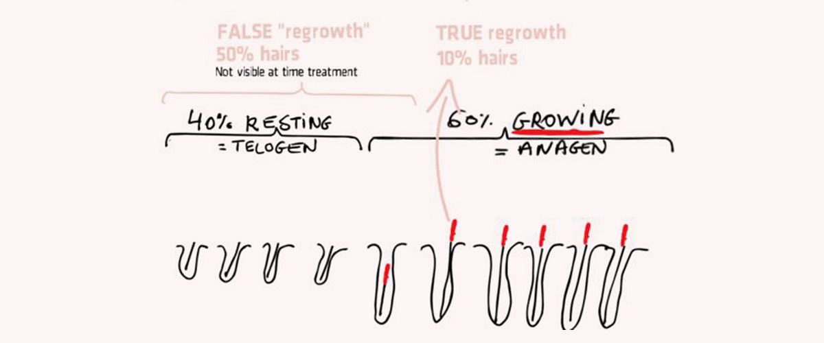 Does hair regrow after electrolysis hair removal?