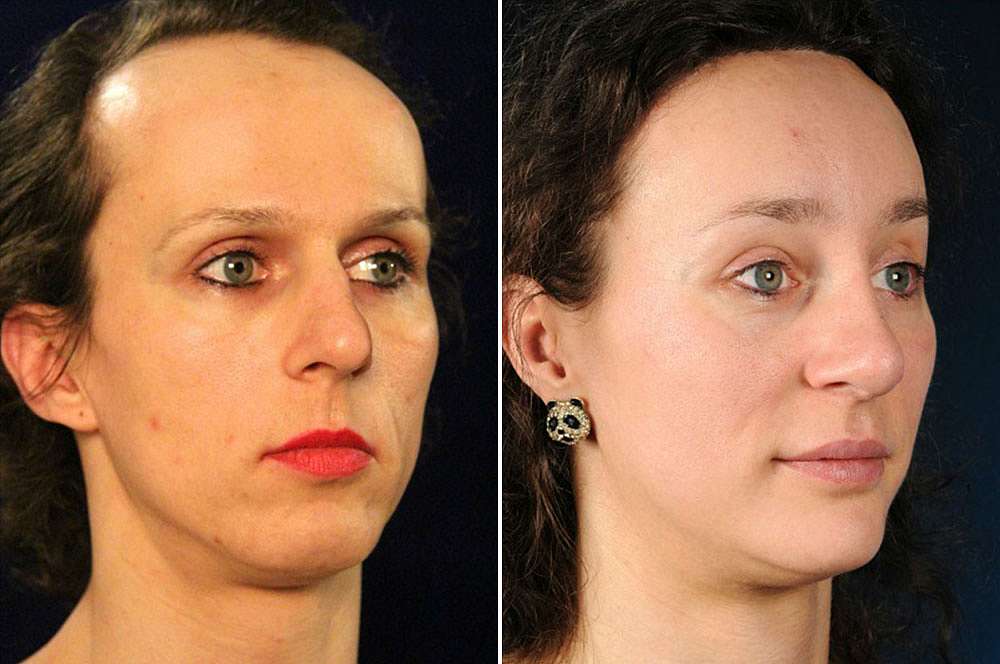 Marie vor und nach der Feminisierung des Gesichts