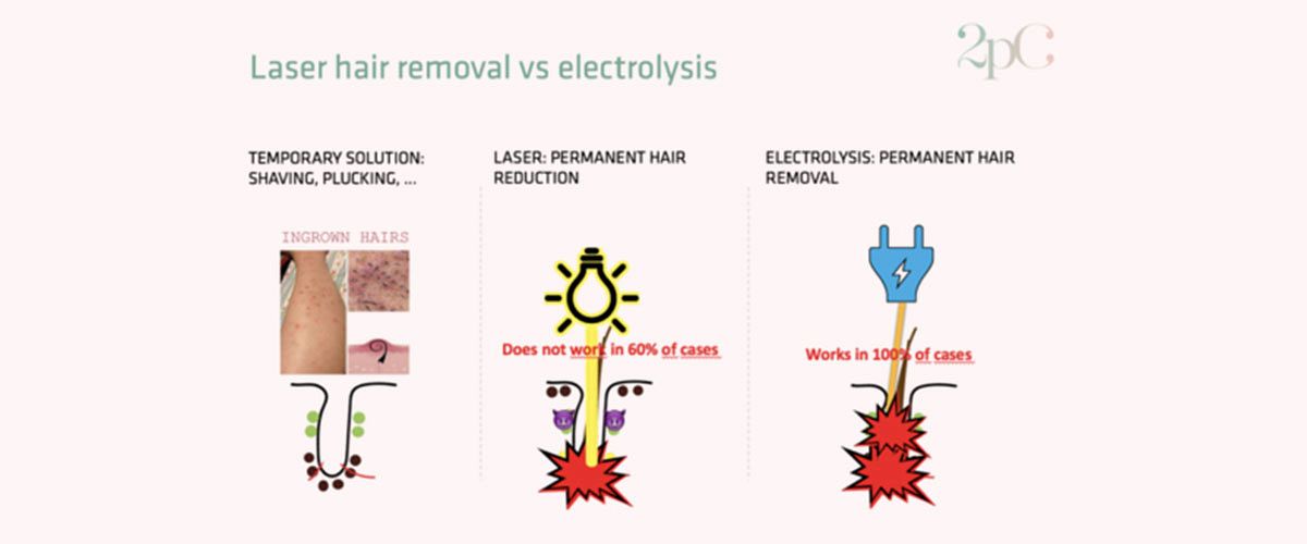 Laser hair removal vs Electrolysis what is the difference? 2pass Clinic