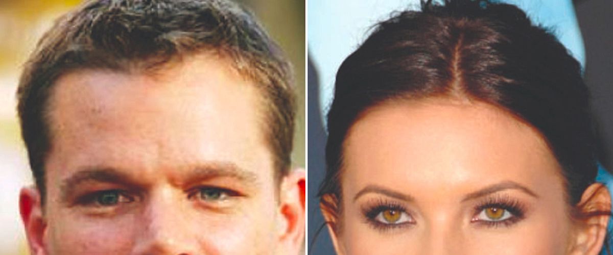 Female hairline vs male hairline: 4 main differences