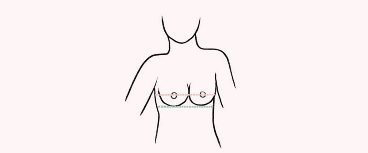 Breast growth during the first year of HRT what can I expect